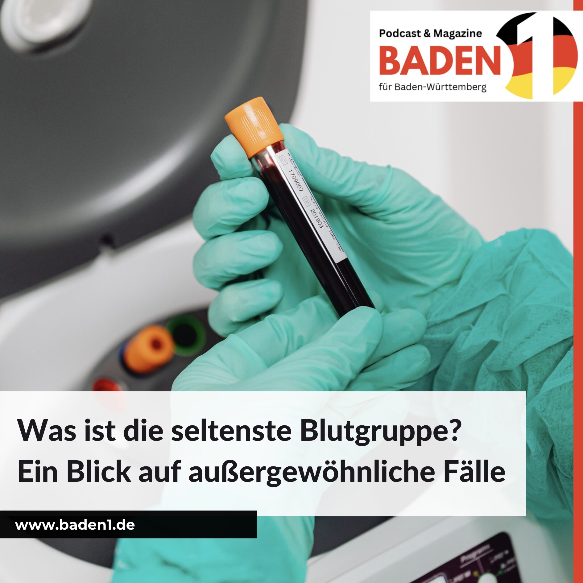 Was ist die seltenste Blutgruppe? Ein Blick auf außergewöhnliche Fälle