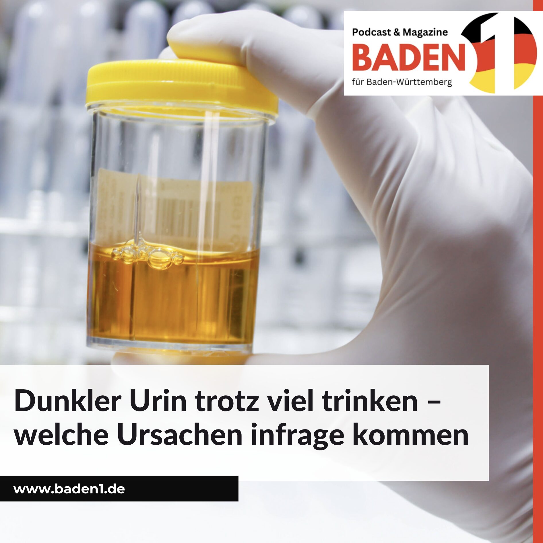 Dunkler Urin trotz viel trinken – welche Ursachen infrage kommen